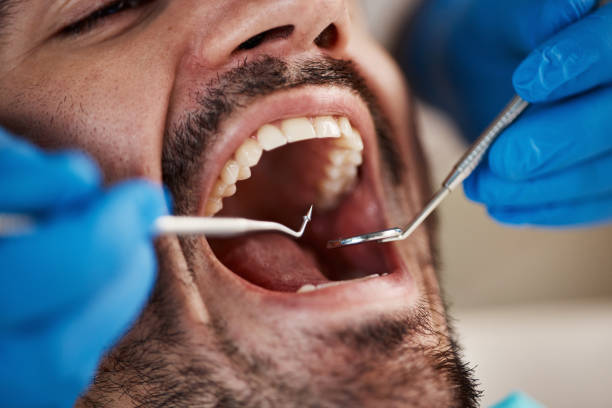 Best Emergency Treatment for Toothache in Utqiagvik, AK